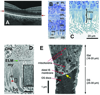 Courtesy Christine Curcio; modified from Schaal and Jonnal.