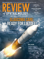 Review of Ophthalmology